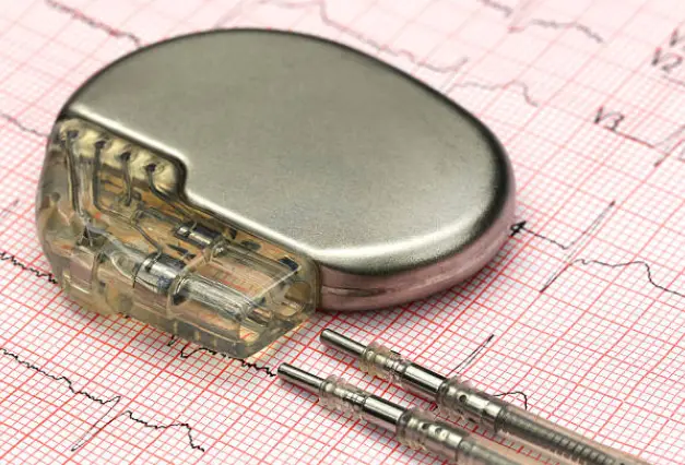 What Happens if you Refuse a Pacemaker