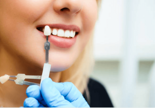 All You Need to Know about Dental Crowns