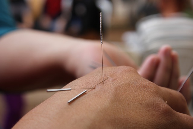Acupuncture vs Dry Needling | Does Insurance cover Acupuncture?