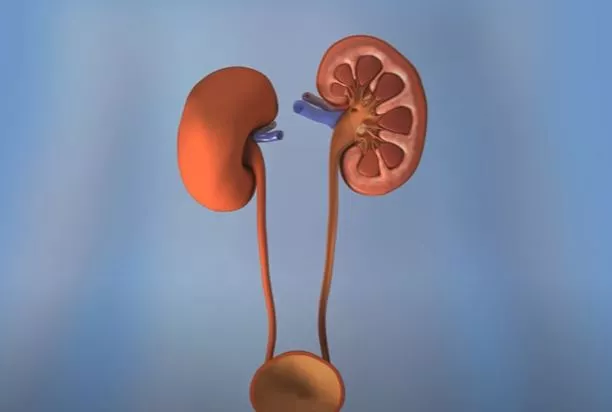 How to Force a Kidney Stone to Pass?