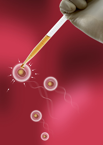 The complete process of IVF treatment