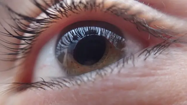 How to Get Something Out of Your Eye Naturally?