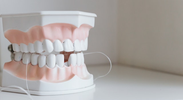 How Much Does a Full Set of Teeth Implants Cost in 2023?