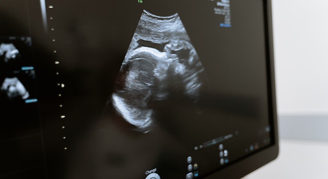 The Role Of Ultrasound Pregnancy